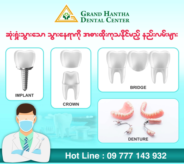 ဆုံးရှုံးသွားသော သွား နေရာကို အစားထိုးကုသနိုင်သော နည်းများ