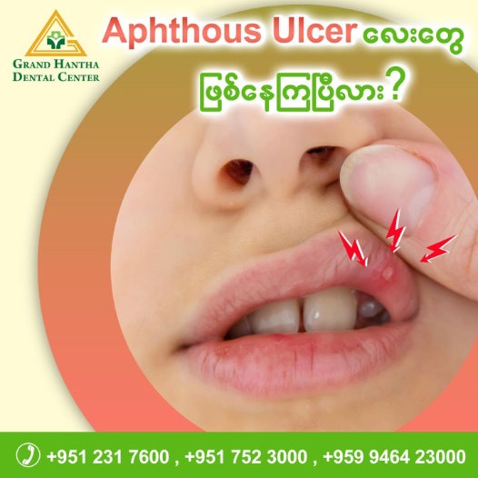 𝐀𝐩𝐡𝐭𝐡𝐨𝐮𝐬 𝐔𝐥𝐜𝐞𝐫 လေးတွေ ဖြစ်နေကြပီလား